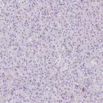 EHD3 Antibody in Immunohistochemistry (Paraffin) (IHC (P))