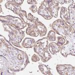 EHD3 Antibody in Immunohistochemistry (Paraffin) (IHC (P))