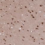 SRSF2 Antibody in Immunohistochemistry (IHC)