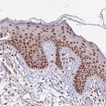 SRSF2 Antibody in Immunohistochemistry (IHC)