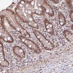 SRSF2 Antibody in Immunohistochemistry (IHC)