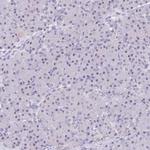 NOP56 Antibody in Immunohistochemistry (Paraffin) (IHC (P))