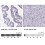 NOP56 Antibody in Immunohistochemistry (IHC)