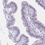 NOP56 Antibody in Immunohistochemistry (IHC)