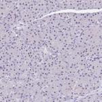 NOP56 Antibody in Immunohistochemistry (IHC)