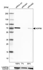 NOP56 Antibody in Western Blot (WB)