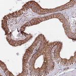 MOGAT1 Antibody in Immunohistochemistry (Paraffin) (IHC (P))