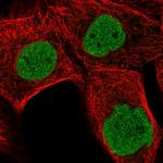 MDFI Antibody in Immunocytochemistry (ICC/IF)