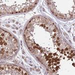 GMNN Antibody in Immunohistochemistry (Paraffin) (IHC (P))