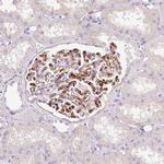 EHD3 Antibody in Immunohistochemistry (IHC)