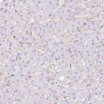 EHD3 Antibody in Immunohistochemistry (IHC)