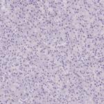 EHD3 Antibody in Immunohistochemistry (IHC)