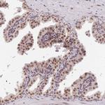 TRIM32 Antibody in Immunohistochemistry (Paraffin) (IHC (P))