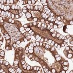 TRIM32 Antibody in Immunohistochemistry (Paraffin) (IHC (P))