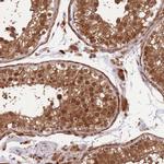 TRIM32 Antibody in Immunohistochemistry (Paraffin) (IHC (P))