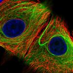 Nesprin 2 Antibody in Immunocytochemistry (ICC/IF)