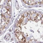 Nesprin 2 Antibody in Immunohistochemistry (IHC)