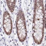 Nesprin 2 Antibody in Immunohistochemistry (IHC)