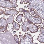 DCHS1 Antibody in Immunohistochemistry (Paraffin) (IHC (P))