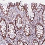 DCHS1 Antibody in Immunohistochemistry (IHC)