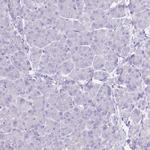 HRG Antibody in Immunohistochemistry (Paraffin) (IHC (P))