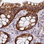 UQCRFS1 Antibody in Immunohistochemistry (IHC)