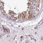 UQCRFS1 Antibody in Immunohistochemistry (IHC)