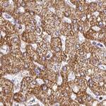 UQCRFS1 Antibody in Immunohistochemistry (IHC)