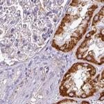 UQCRFS1 Antibody in Immunohistochemistry (IHC)