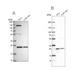 UQCRFS1 Antibody in Western Blot (WB)