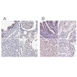 NHP2 Antibody in Immunohistochemistry (IHC)