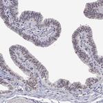 NHP2 Antibody in Immunohistochemistry (IHC)