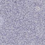 NHP2 Antibody in Immunohistochemistry (IHC)