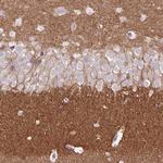 DPP6 Antibody in Immunohistochemistry (Paraffin) (IHC (P))