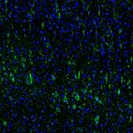 DPP6 Antibody in Immunohistochemistry (Paraffin) (IHC (P))