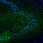 DPP6 Antibody in Immunohistochemistry (Paraffin) (IHC (P))