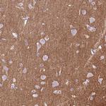 DPP6 Antibody in Immunohistochemistry (Paraffin) (IHC (P))