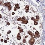 STEAP3 Antibody in Immunohistochemistry (Paraffin) (IHC (P))