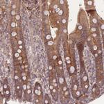 STEAP3 Antibody in Immunohistochemistry (Paraffin) (IHC (P))