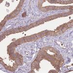 STEAP3 Antibody in Immunohistochemistry (Paraffin) (IHC (P))