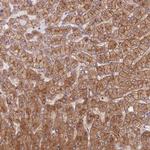 STEAP3 Antibody in Immunohistochemistry (Paraffin) (IHC (P))