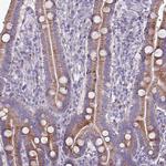 HSD3B7 Antibody in Immunohistochemistry (Paraffin) (IHC (P))