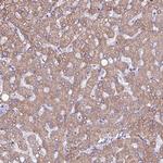 HSD3B7 Antibody in Immunohistochemistry (Paraffin) (IHC (P))