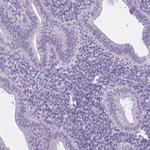 RFX4 Antibody in Immunohistochemistry (Paraffin) (IHC (P))