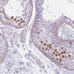 RFX4 Antibody in Immunohistochemistry (Paraffin) (IHC (P))