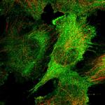 CAP2 Antibody in Immunocytochemistry (ICC/IF)