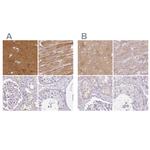 CAP2 Antibody in Immunohistochemistry (IHC)