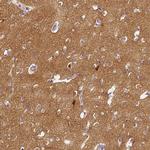 CAP2 Antibody in Immunohistochemistry (IHC)