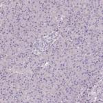 CAP2 Antibody in Immunohistochemistry (IHC)