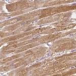 CAP2 Antibody in Immunohistochemistry (IHC)